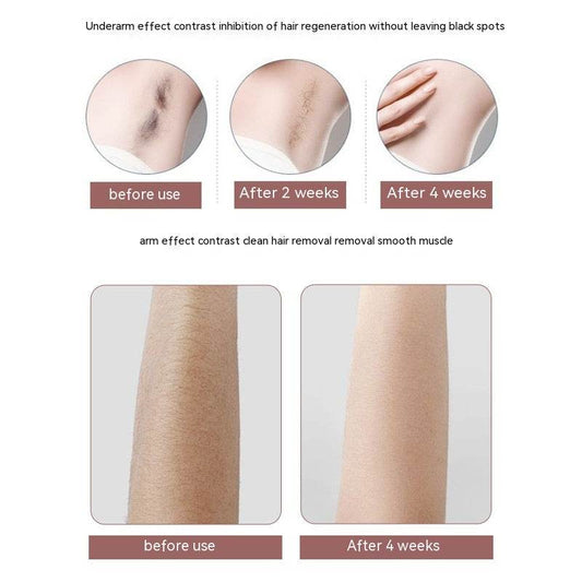 Women Hair Remover Household Men's And Women's Lady Shaver Painless Freezing Point Depilator - Here2Save