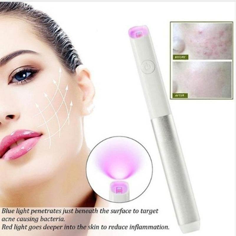 Household Safety Red Blue Light Smallpox Diluting Acne Beauty Instrument - Here2Save