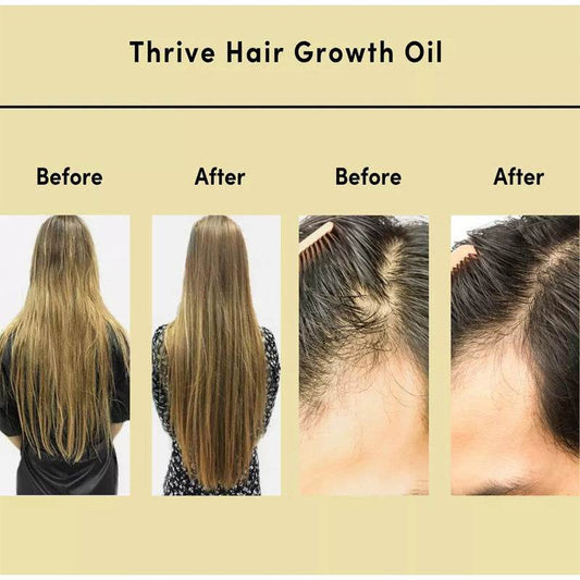 Hair Essential Oil Improve Dryness And Irritability And Nourish - Here2Save
