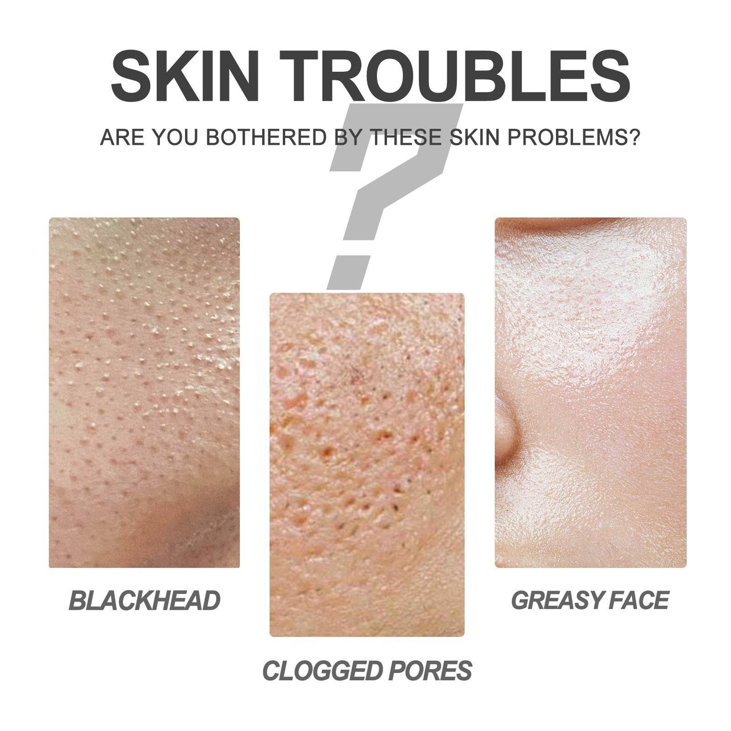 Blackhead Cleansing Cream Skin Oil Acne Cutin Cleaning - Here2Save