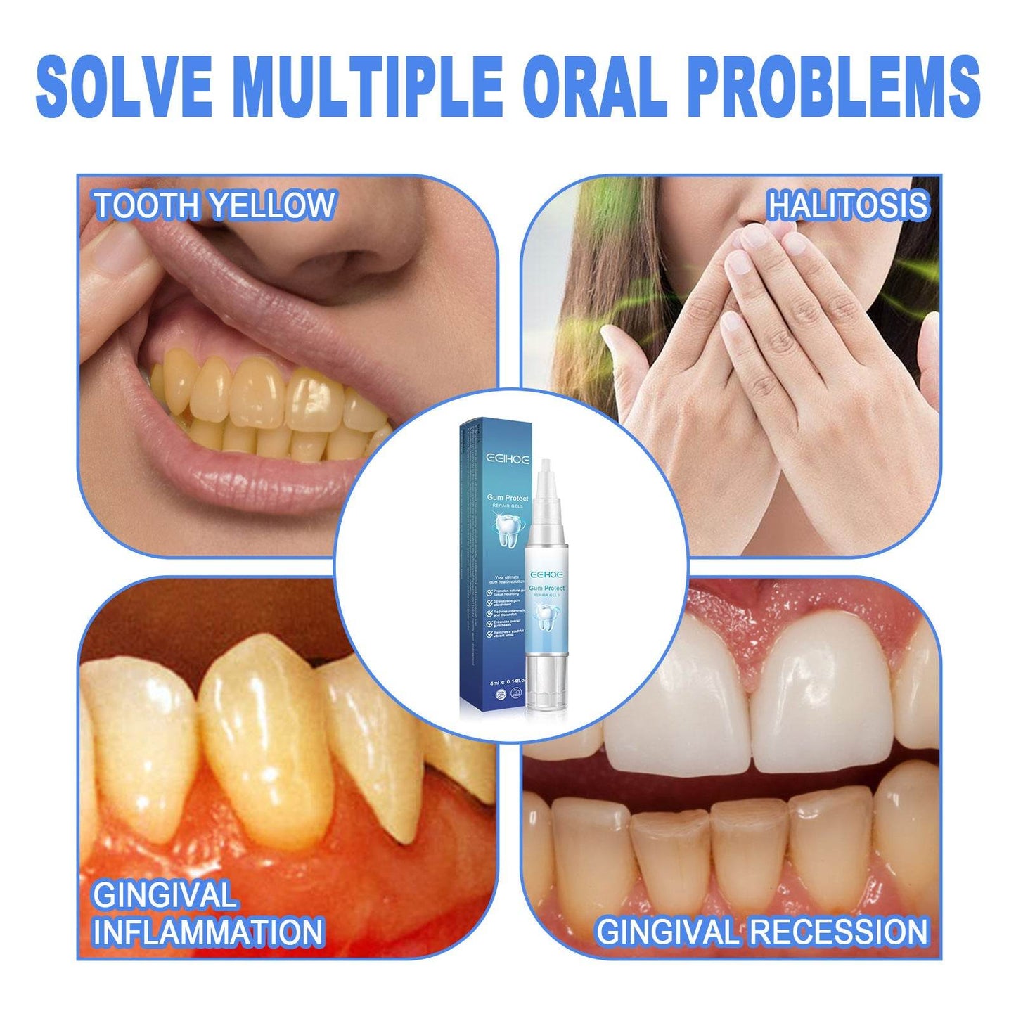 Teeth Repair Gel Swelling And Aching Of Gum Deep Cleaning - Here2Save