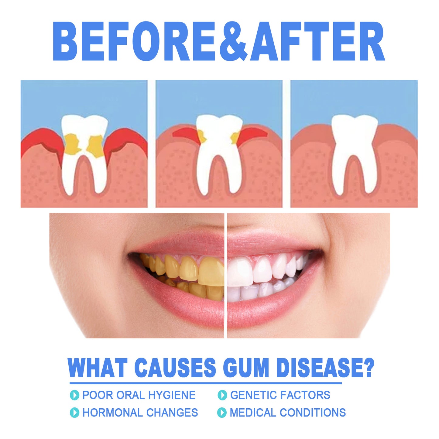 Teeth Repair Gel Swelling And Aching Of Gum Deep Cleaning