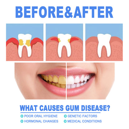 Teeth Repair Gel Swelling And Aching Of Gum Deep Cleaning