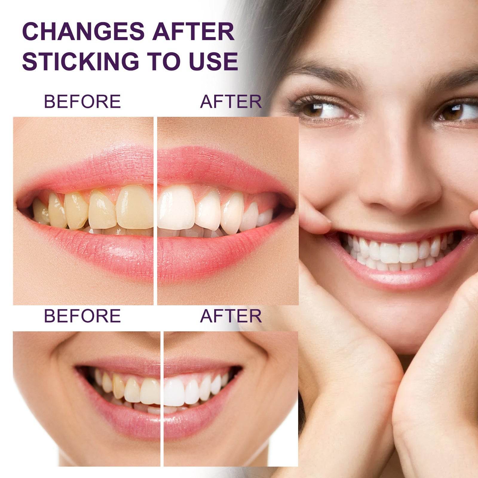 Toothpaste Tooth Stain Removal Cleaning Whitening Anti Pigment Precipitation - Here2Save
