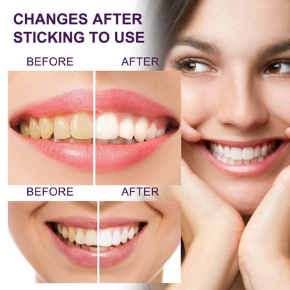 Toothpaste Tooth Stain Removal Cleaning Whitening Anti Pigment Precipitation - Here2Save